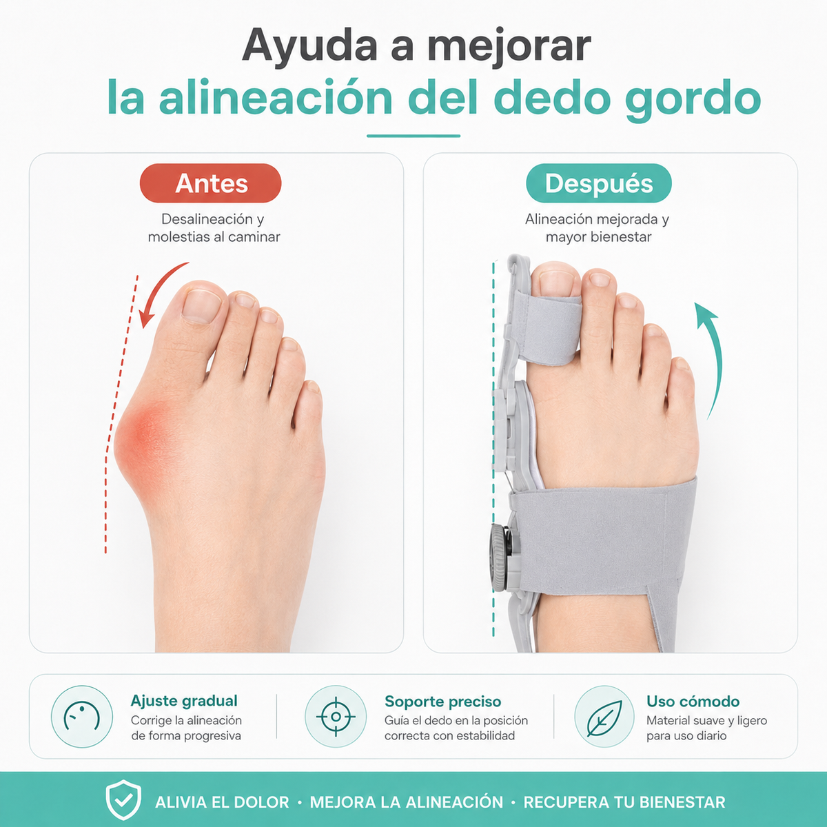 Corrector de Juanetes Ajustable – Comodidad y Alineación para tus Pies