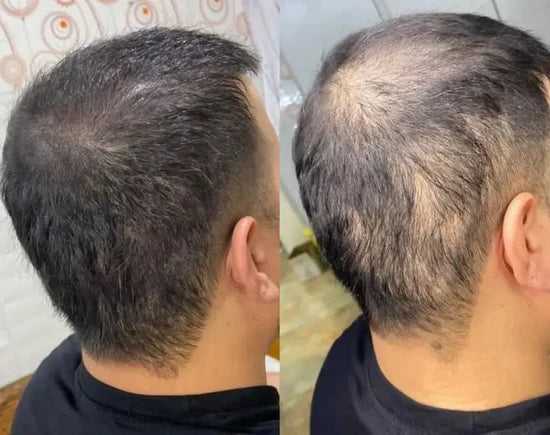 Cabello más sano